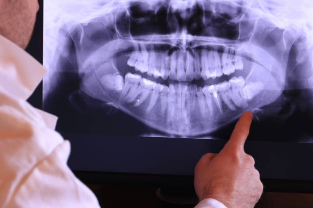 Best Tooth Pain Emergency Relief  in Cache, OK